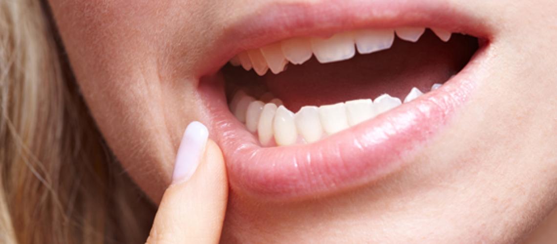 Conheça as doenças que podem se manifestar pela boca